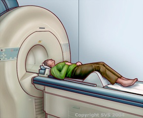 Computed Tomography Angiography (CTA) and Magnetic Resonance Angiography (MRA) Tests